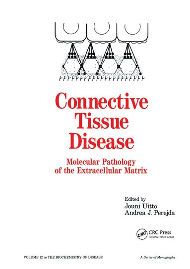 bokomslag Connective Tissue Disease