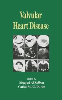 bokomslag Valvular Heart Disease