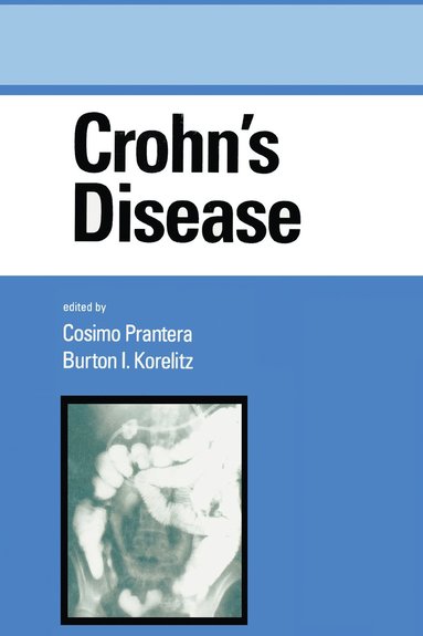 bokomslag Crohn's Disease