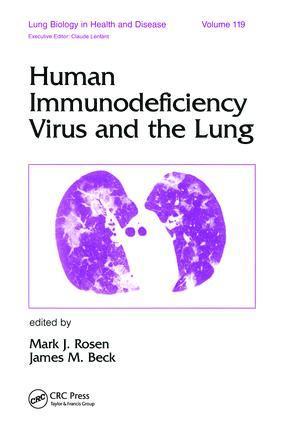 bokomslag Human Immunodeficiency Virus and the Lung