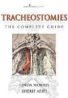 Tracheostomies: The Complete Guide