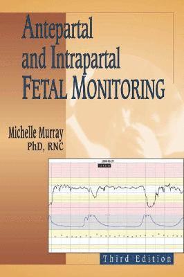 Michelle Murray - Antepartal and Intrapartal Fetal Monitoring, Häftad