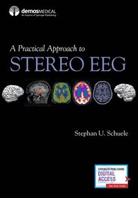 bokomslag A Practical Approach to Stereo EEG