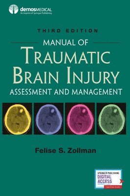 bokomslag Manual of Traumatic Brain Injury