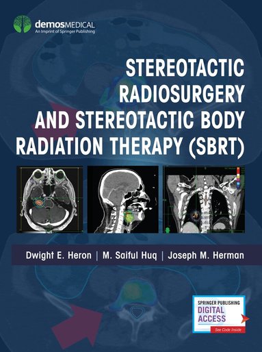 Dwight E. Heron, M. Saiful Huq, Joseph M. Herman - Stereotactic Radiosurgery and Stereotactic Body Radiation Therapy (SBRT), Inbunden