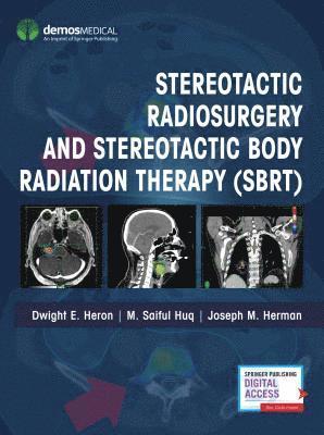 Stereotactic Radiosurgery and Stereotactic Body Radiation Therapy (SBRT) 1