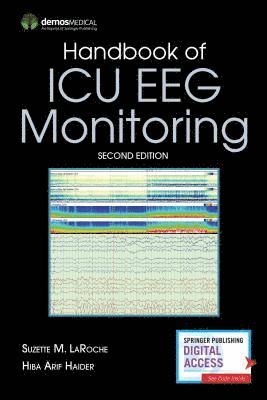 Handbook of ICU EEG Monitoring 1