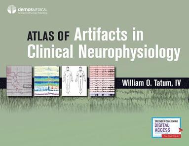 bokomslag Atlas of Artifacts in Clinical Neurophysiology