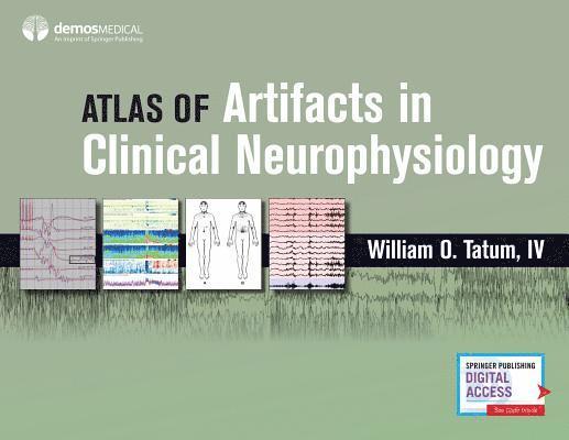 Atlas of Artifacts in Clinical Neurophysiology 1