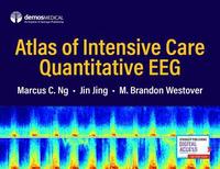 bokomslag Atlas of Intensive Care Quantitative EEG