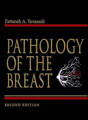 Pathology of The Breast