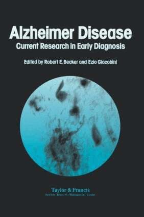 Robert Becker - Alzheimer's Disease, Inbunden