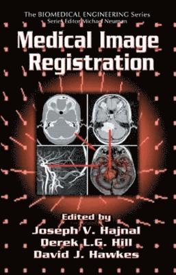 Medical Image Registration 1