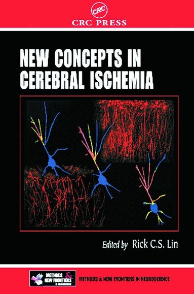 Rick C. S. Lin - New Concepts in Cerebral Ischemia, Inbunden