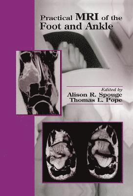 Practical MRI of the Foot and Ankle