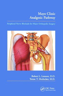 bokomslag Mayo Clinic Analgesic Pathway