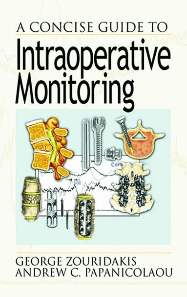 George Zouridakis, Andrew C. Papanicolaou - Concise Guide to Intraoperative Monitoring, Inbunden