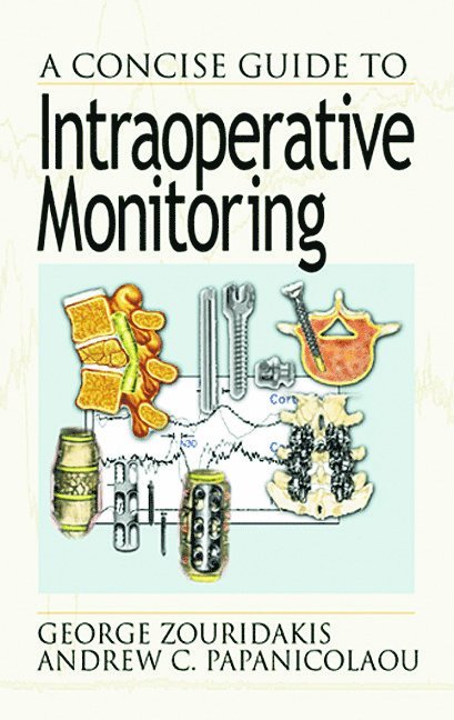 Concise Guide to Intraoperative Monitoring