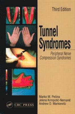 Tunnel Syndromes 1