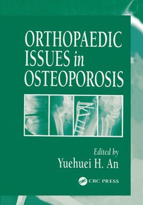 Orthopaedic Issues in Osteoporosis 1