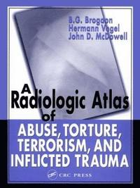 bokomslag A Radiologic Atlas of Abuse, Torture, Terrorism, and Inflicted Trauma