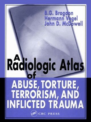 B. G. Brogdon, Hermann Vogel, John D. McDowell - Radiologic Atlas of Abuse, Torture, Terrorism, and Inflicted Trauma, Inbunden