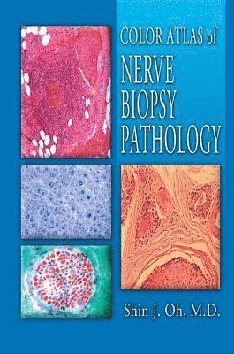 bokomslag Color Atlas of Nerve Biopsy Pathology