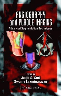 bokomslag Angiography and Plaque Imaging