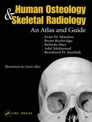 Evan W. Matshes, Bernard Juurlink, Canada) Matshes, Evan W. (University of Calgary and Academic Forensic Pathology Inc., Calgary, Alberta, Canada) Juurlink, Bernard (University of Saskatchewan, Saskatoon - Human Osteology and Skeletal Radiology, Inbunden