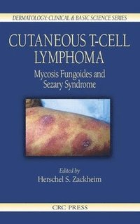 bokomslag Cutaneous T-Cell Lymphoma