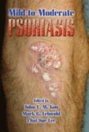 bokomslag Mild to Moderate Psoriasis