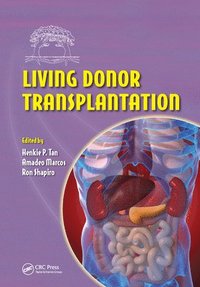bokomslag Living Donor Transplantation