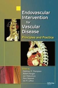 bokomslag Endovascular Intervention for Vascular Disease