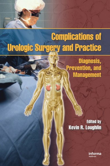 bokomslag Complications of Urologic Surgery and Practice