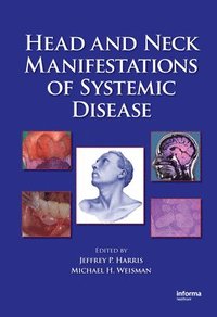 bokomslag Head and Neck Manifestations of Systemic Disease