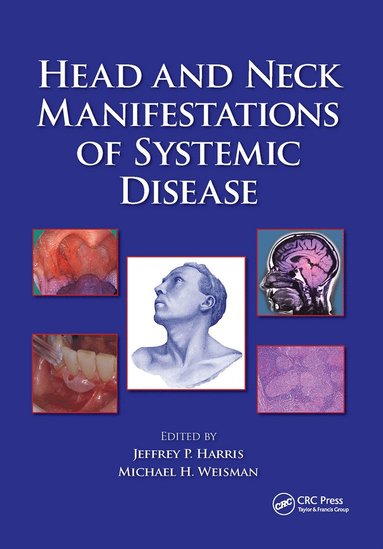 bokomslag Head and Neck Manifestations of Systemic Disease