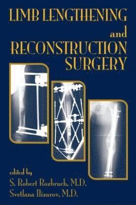 S. Robert Rozbruch, Svetlana Ilizarov, USA) Rozbruch, S. Robert (Weill Medical College of Cornell University, New York, NY, USA) Ilizarov, Svetlana (Weill Medical College of Cornell University, New York, NY - Limb Lengthening and Reconstruction Surgery, Inbunden