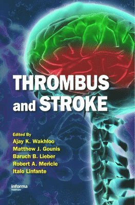 Thrombus and Stroke 1