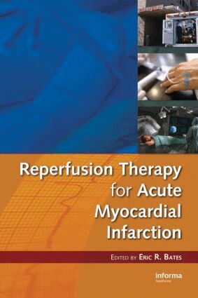 Eric R. Bates - Reperfusion Therapy for Acute Myocardial Infarction, Inbunden