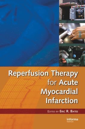 bokomslag Reperfusion Therapy for Acute Myocardial Infarction