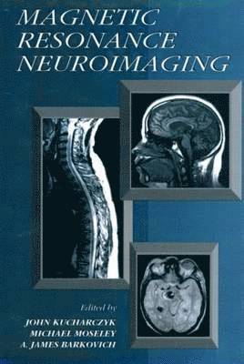 bokomslag Magnetic Resonance Neuroimaging