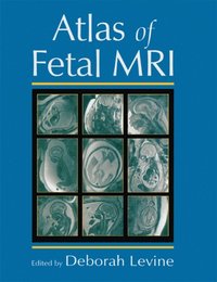 bokomslag Atlas of Fetal MRI