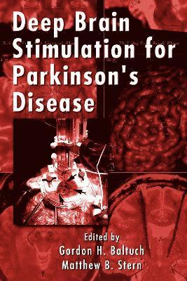 Deep Brain Stimulation for Parkinson's Disease 1