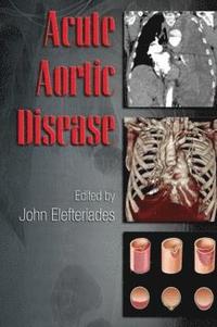 bokomslag Acute Aortic Disease
