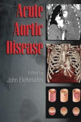 Acute Aortic Disease 1