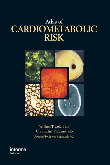 bokomslag Atlas of Cardiometabolic Risk