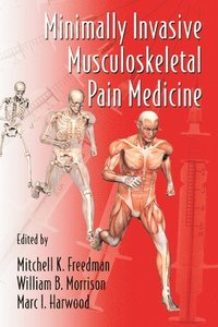 bokomslag Minimally Invasive Musculoskeletal Pain Medicine