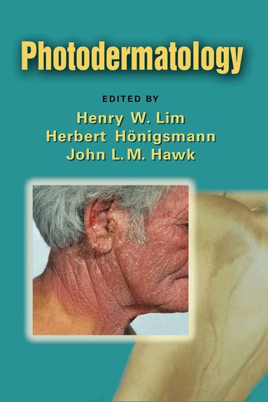 Henry W. Lim, Herbert Honigsmann, John L. M. Hawk - Photodermatology, Inbunden