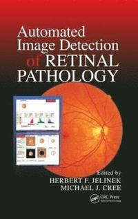 bokomslag Automated Image Detection of Retinal Pathology