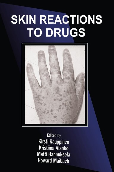 Kirsti Kauppinen, Kristiina Alanko, Matti Hannuksela, Howard I. Maibach - Skin Reactions to Drugs, Inbunden